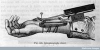 A diagram of Marey's sphygmograph.